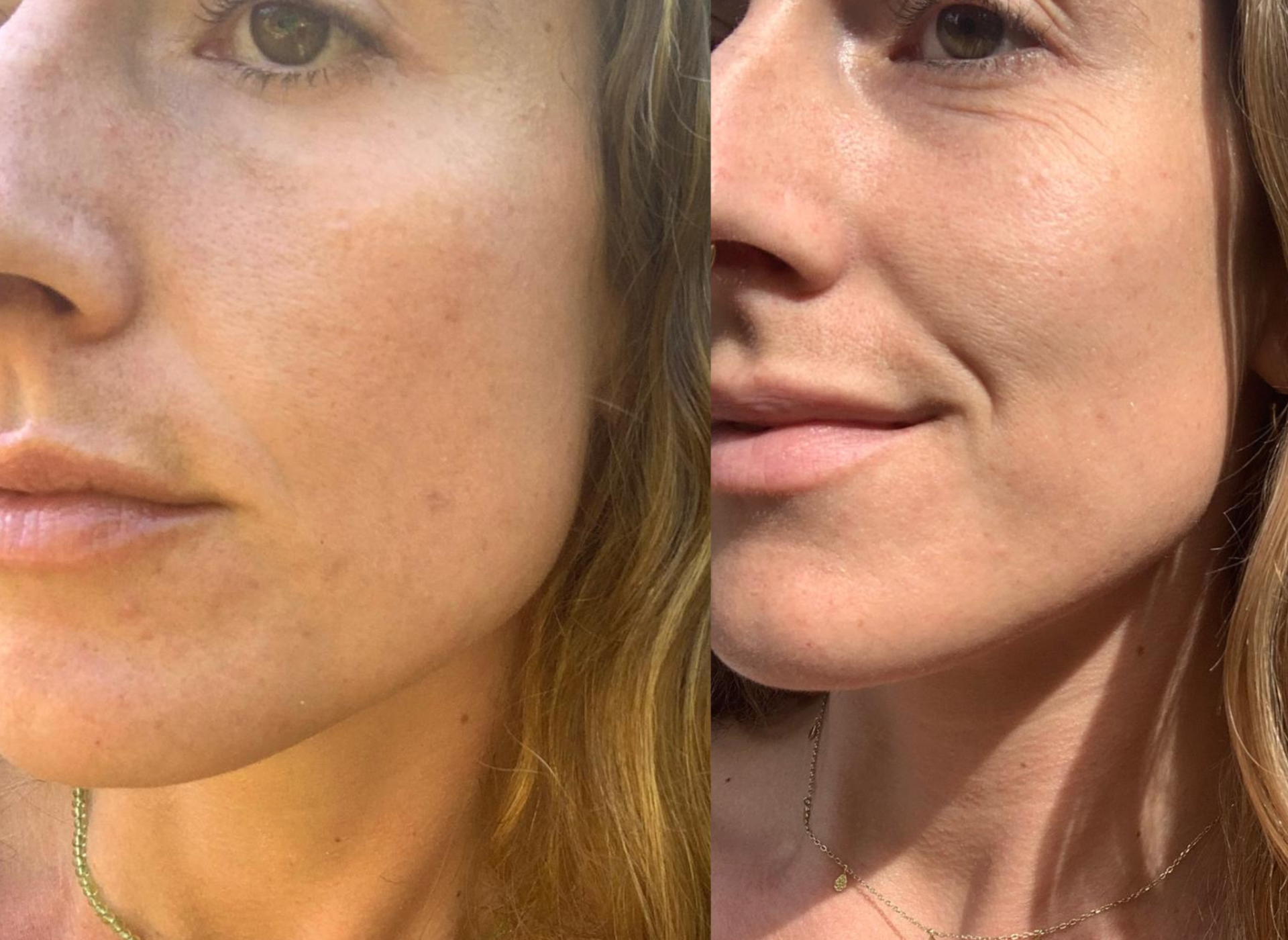 Client SUCCESS results